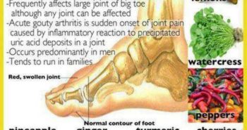 Kevin Angileri Superfoods to Alleviate the Symptoms of Gout